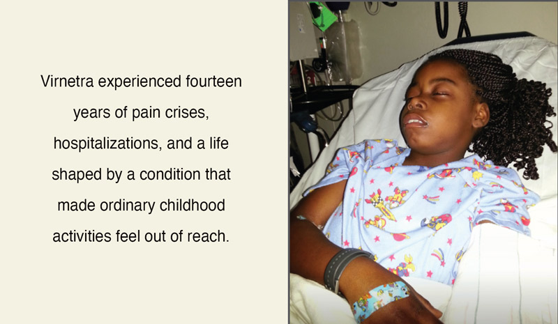 child with sickle cell disease